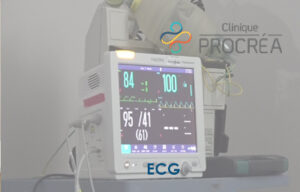 électrocardiographie (ECG)