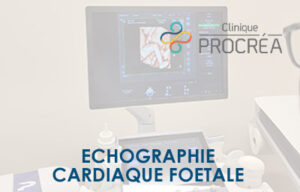Echographie cardiaque fœtale