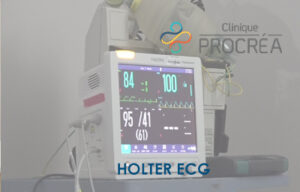 Holter ECG
